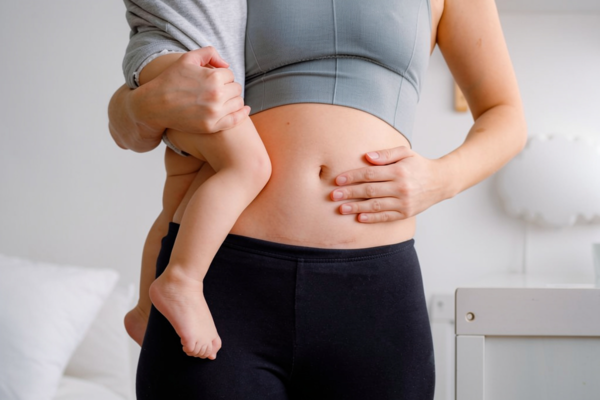 cesarienne-programmee